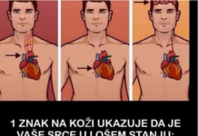 1 ZNAK NA KOŽI UKAZUJE DA JE VAŠE SRCE U LOŠEM STANJU: Ako ovo primijetite javite se doktoru ODMAH! 1 ZNAK NA KOŽI UKAZUJE DA JE VAŠE SRCE U LOŠEM STANJU: Ako ovo primijetite javite se doktoru ODMAH!