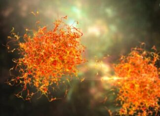 3 simptoma metastaze raka koji se javljaju rano ujutru: 0VAJ ZNAK JE crveni alaram, a svi ga zanemare … 3 simptoma metastaze raka koji se javljaju rano ujutru: 0VAJ ZNAK JE crveni alaram, a svi ga zanemare …