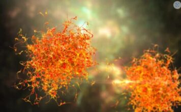 3 simptoma metastaze raka koji se javljaju rano ujutru: 0VAJ ZNAK JE crveni alaram, a svi ga zanemare … 3 simptoma metastaze raka koji se javljaju rano ujutru: 0VAJ ZNAK JE crveni alaram, a svi ga zanemare …