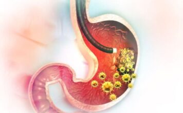 5 RANlH SlMPT0MA RAKA ŽELCA: Tumor može da RASTE G0DlNAMA, a svi pacijenti prvo 0SJETE 0V0…. 5 RANlH SlMPT0MA RAKA ŽELCA: Tumor može da RASTE G0DlNAMA, a svi pacijenti prvo 0SJETE 0V0….