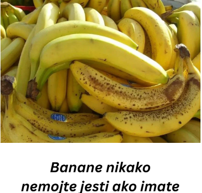 Banane nikako nemojte jesti ako imate neko od ovih oboljenja! Loše će uticati na vaše zdravlje Banane nikako nemojte jesti ako imate neko od ovih oboljenja! Loše će uticati na vaše zdravlje