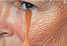 Bez obzira imate li 70 godina, ako ga nanesete na bore, lice će vam biti zategnuto kao staklo. Učinkovitiji je od botoksa. Bez obzira imate li 70 godina, ako ga nanesete na bore, lice će vam biti zategnuto kao staklo. Učinkovitiji je od botoksa.