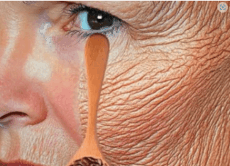 Bez obzira imate li 70 godina, ako ga nanesete na bore, lice će vam biti zategnuto kao staklo. Učinkovitiji je od botoksa. Bez obzira imate li 70 godina, ako ga nanesete na bore, lice će vam biti zategnuto kao staklo. Učinkovitiji je od botoksa.