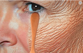 Bez obzira imate li 70 godina, ako ga nanesete na bore, lice će vam biti zategnuto kao staklo. Učinkovitiji je od botoksa. Bez obzira imate li 70 godina, ako ga nanesete na bore, lice će vam biti zategnuto kao staklo. Učinkovitiji je od botoksa.