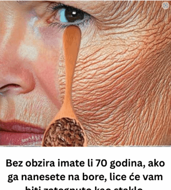 Bez obzira imate li 70 godina, ako ga nanesete na bore, lice će vam biti zategnuto kao staklo. Učinkovitiji je od botoksa. Bez obzira imate li 70 godina, ako ga nanesete na bore, lice će vam biti zategnuto kao staklo. Učinkovitiji je od botoksa.