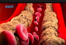 Holesterol ne skače od mesa, već od ove 2 stvari koje su smrt za jetru i samo gomilaju masnoću Holesterol ne skače od mesa, već od ove 2 stvari koje su smrt za jetru i samo gomilaju masnoću