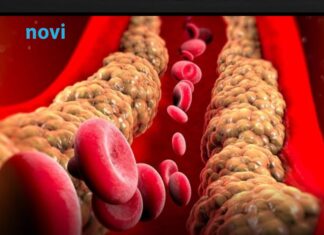 Holesterol ne skače od mesa, već od ove 2 stvari koje su smrt za jetru i samo gomilaju masnoću Holesterol ne skače od mesa, već od ove 2 stvari koje su smrt za jetru i samo gomilaju masnoću