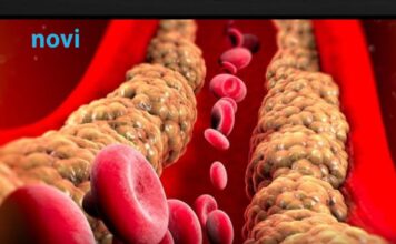 Holesterol ne skače od mesa, već od ove 2 stvari koje su smrt za jetru i samo gomilaju masnoću Holesterol ne skače od mesa, već od ove 2 stvari koje su smrt za jetru i samo gomilaju masnoću