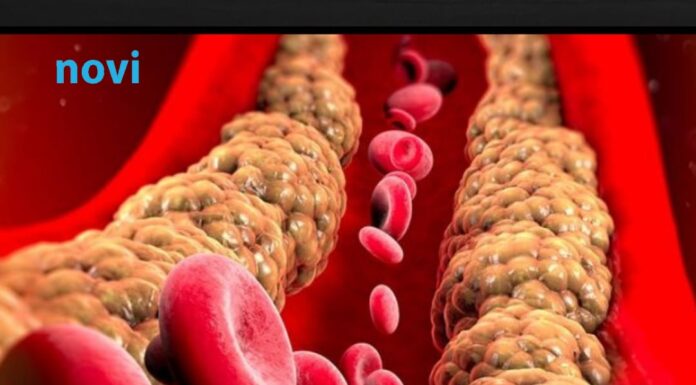 Holesterol ne skače od mesa, već od ove 2 stvari koje su smrt za jetru i samo gomilaju masnoću Holesterol ne skače od mesa, već od ove 2 stvari koje su smrt za jetru i samo gomilaju masnoću