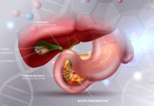 Koja hrana je strogo zabranjena ljudima sa kamenom u žuči? Može da pokrene napad ili upalu Koja hrana je strogo zabranjena ljudima sa kamenom u žuči? Može da pokrene napad ili upalu