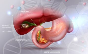 Koja hrana je strogo zabranjena ljudima sa kamenom u žuči? Može da pokrene napad ili upalu Koja hrana je strogo zabranjena ljudima sa kamenom u žuči? Može da pokrene napad ili upalu