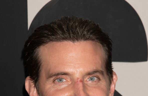 Novo zabrinjavajuće pojavljivanje Bredlija Kupera: Ljudi komentarišu kako ga je pojela plastična operacija Novo zabrinjavajuće pojavljivanje Bredlija Kupera: Ljudi komentarišu kako ga je pojela plastična operacija