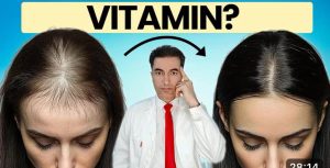 OPASNO: Deficit ovog vitamina UZROKUJE gubitak kose kod žena ! OPASNO: Deficit ovog vitamina UZROKUJE gubitak kose kod žena !