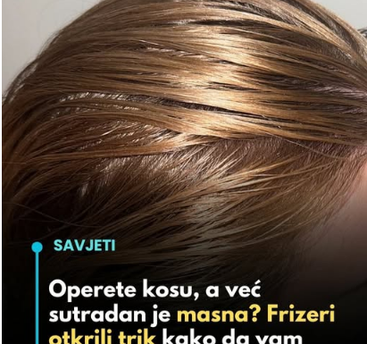 Operete kosu, a već sutradan je masna Frizeri otkrili trik kako da vam bude čista i nekoliko dana Operete kosu, a već sutradan je masna Frizeri otkrili trik kako da vam bude čista i nekoliko dana