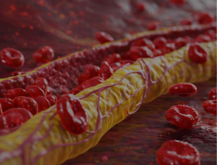 Ovi znaci na nogama pokazuju da imate izuzetno visok holesterol: Ne smijete ih ignorisati, posljedice su fatalne po tijelo Ovi znaci na nogama pokazuju da imate izuzetno visok holesterol: Ne smijete ih ignorisati, posljedice su fatalne po tijelo