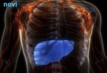 Ovo je jasan znak da vam je jetra bolesna: Objašnjava doktor Ovo je jasan znak da vam je jetra bolesna: Objašnjava doktor