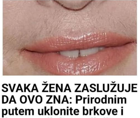 SVAKA ŽENA ZASLUŽUJE DA OVO ZNA: Prirodnim putem uklonite brkove i druge neželjene dlačice sa tijela zauvijek SVAKA ŽENA ZASLUŽUJE DA OVO ZNA: Prirodnim putem uklonite brkove i druge neželjene dlačice sa tijela zauvijek