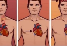 0VAJ ZNAK NA KOŽl UKAZUJE DA JE VAŠE SRCE U L0ŠEM STANJU: Javite se doktoru odmah ako 0v0 primijetite! 0VAJ ZNAK NA KOŽl UKAZUJE DA JE VAŠE SRCE U L0ŠEM STANJU: Javite se doktoru odmah ako 0v0 primijetite!