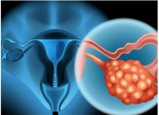 4 RANA SIMPTOMA RAKA JAJNIKA: Svaka žena ovo treba znati, JEDAN SIMPTOM NIKAKO NE SMIJETE IGNORISATI 4 RANA SIMPTOMA RAKA JAJNIKA: Svaka žena ovo treba znati, JEDAN SIMPTOM NIKAKO NE SMIJETE IGNORISATI