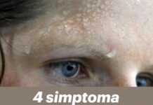 4 simptoma srčanog udara koji se obično pojavljuju nekoliko dana unaprijed. 4 simptoma srčanog udara koji se obično pojavljuju nekoliko dana unaprijed.