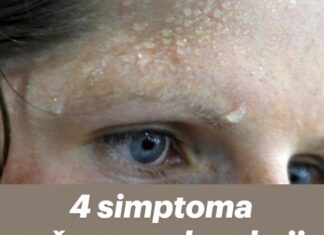 4 simptoma srčanog udara koji se obično pojavljuju nekoliko dana unaprijed. 4 simptoma srčanog udara koji se obično pojavljuju nekoliko dana unaprijed.