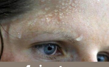 4 simptoma srčanog udara koji se obično pojavljuju nekoliko dana unaprijed. 4 simptoma srčanog udara koji se obično pojavljuju nekoliko dana unaprijed.