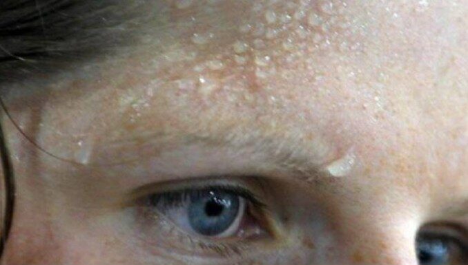 4 simptoma srčanog udara koji se obično pojavljuju nekoliko dana unaprijed. 4 simptoma srčanog udara koji se obično pojavljuju nekoliko dana unaprijed.