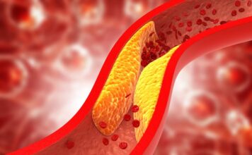 7 navika koje polako ubijaju krvne sudove: Tvrdi karidolog Dimitrij Sokolov 7 navika koje polako ubijaju krvne sudove: Tvrdi karidolog Dimitrij Sokolov