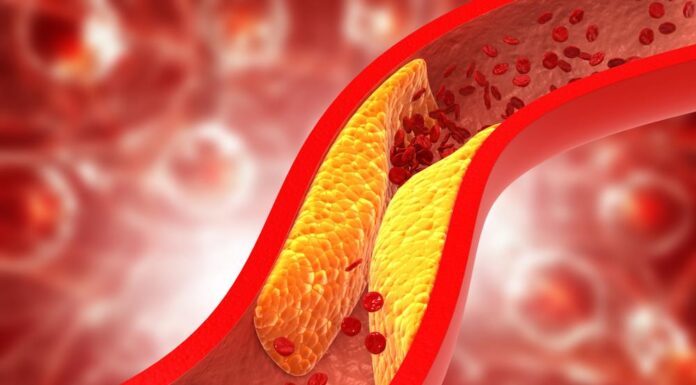 7 navika koje polako ubijaju krvne sudove: Tvrdi karidolog Dimitrij Sokolov 7 navika koje polako ubijaju krvne sudove: Tvrdi karidolog Dimitrij Sokolov