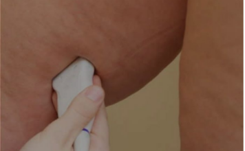 7 ZNAKOVA DA IMATE NEDOSTATAK VITAMINA “D”: Niste ni svjesni kako teško može da utiče na vaše zdravlje 7 ZNAKOVA DA IMATE NEDOSTATAK VITAMINA “D”: Niste ni svjesni kako teško može da utiče na vaše zdravlje