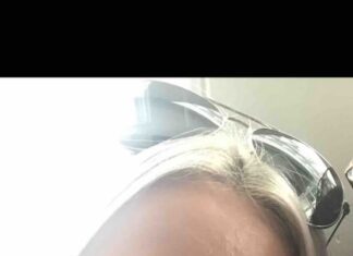 “Bože, zašto me jednostavno niste poslali na skener?”: Lekari ženu zbog 2 simptoma ubeđivali da je u menopauzi, a sad prodaje kuću da plati lečenje raka "Bože, zašto me jednostavno niste poslali na skener?": Lekari ženu zbog 2 simptoma ubeđivali da je u menopauzi, a sad prodaje kuću da plati lečenje raka