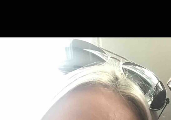 “Bože, zašto me jednostavno niste poslali na skener?”: Lekari ženu zbog 2 simptoma ubeđivali da je u menopauzi, a sad prodaje kuću da plati lečenje raka "Bože, zašto me jednostavno niste poslali na skener?": Lekari ženu zbog 2 simptoma ubeđivali da je u menopauzi, a sad prodaje kuću da plati lečenje raka