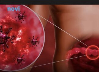 Opasni virus počeo da se širi prije praznika: Ovo su simptomi! Opasni virus počeo da se širi prije praznika: Ovo su simptomi!