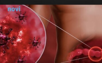 Opasni virus počeo da se širi prije praznika: Ovo su simptomi! Opasni virus počeo da se širi prije praznika: Ovo su simptomi!