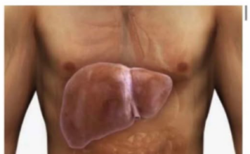 PAZITE NA JETRU! Ovih 8 simptoma mogu ukazivati na problem – reagujte na vrijeme PAZITE NA JETRU! Ovih 8 simptoma mogu ukazivati na problem – reagujte na vrijeme