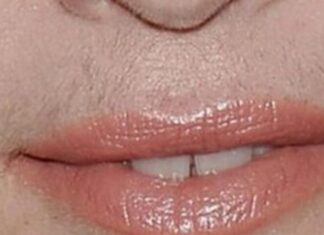 SVAKA ŽENA ZASLUŽUJE DA ZNA: Uklonite brkove i druge neželjene dlačice sa tijela zauvijek… SVAKA ŽENA ZASLUŽUJE DA ZNA: Uklonite brkove i druge neželjene dlačice sa tijela zauvijek…