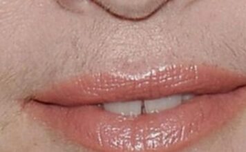 SVAKA ŽENA ZASLUŽUJE DA ZNA: Uklonite brkove i druge neželjene dlačice sa tijela zauvijek… SVAKA ŽENA ZASLUŽUJE DA ZNA: Uklonite brkove i druge neželjene dlačice sa tijela zauvijek…