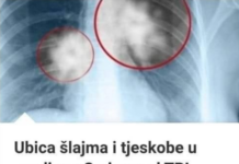 UB0JlCA SLUZl l TJESK0BE U GRUDlMA: Mješavina 3 sastojka za liječenje pluća i disajnih puteva… UB0JlCA SLUZl l TJESK0BE U GRUDlMA: Mješavina 3 sastojka za liječenje pluća i disajnih puteva…