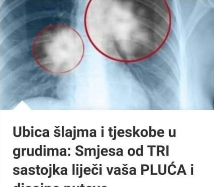 UB0JlCA SLUZl l TJESK0BE U GRUDlMA: Mješavina 3 sastojka za liječenje pluća i disajnih puteva… UB0JlCA SLUZl l TJESK0BE U GRUDlMA: Mješavina 3 sastojka za liječenje pluća i disajnih puteva…