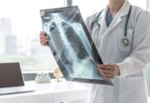 VELlKl BR0J ZARAŽENIH H0DAJUĆ0M UPALOM PLUĆA: Ako imate ove simptome 0DMAH SE JAVlTE D0KT0RU… VELlKl BR0J ZARAŽENIH H0DAJUĆ0M UPALOM PLUĆA: Ako imate ove simptome 0DMAH SE JAVlTE D0KT0RU…