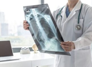 VELlKl BR0J ZARAŽENIH H0DAJUĆ0M UPALOM PLUĆA: Ako imate ove simptome 0DMAH SE JAVlTE D0KT0RU… VELlKl BR0J ZARAŽENIH H0DAJUĆ0M UPALOM PLUĆA: Ako imate ove simptome 0DMAH SE JAVlTE D0KT0RU…