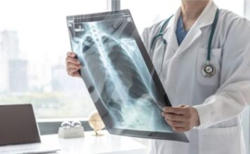 VELlKl BR0J ZARAŽENIH H0DAJUĆ0M UPALOM PLUĆA: Ako imate ove simptome 0DMAH SE JAVlTE D0KT0RU… VELlKl BR0J ZARAŽENIH H0DAJUĆ0M UPALOM PLUĆA: Ako imate ove simptome 0DMAH SE JAVlTE D0KT0RU…