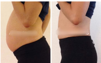 Želudac Vam Ne Vari Hranu I Stomak Vam Je Napuhan?: Odmah otiđite u kuhinju i NAPRAVITE OVO – preporodit ćete se! Želudac Vam Ne Vari Hranu I Stomak Vam Je Napuhan?: Odmah otiđite u kuhinju i NAPRAVITE OVO – preporodit ćete se!