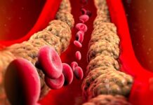 7 namirnica koje snižavaju holesterol: Za prohodne krvne sudove, ubacite ovo u svoju ishranu odmah 7 namirnica koje snižavaju holesterol: Za prohodne krvne sudove, ubacite ovo u svoju ishranu odmah