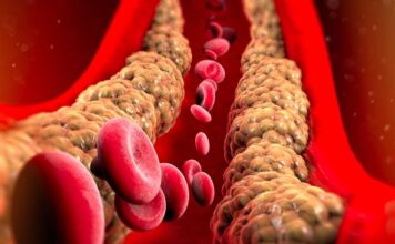 7 namirnica koje snižavaju holesterol: Za prohodne krvne sudove, ubacite ovo u svoju ishranu odmah 7 namirnica koje snižavaju holesterol: Za prohodne krvne sudove, ubacite ovo u svoju ishranu odmah