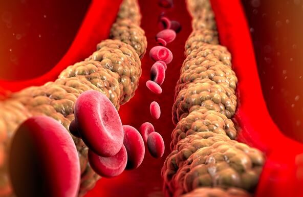 7 namirnica koje snižavaju holesterol: Za prohodne krvne sudove, ubacite ovo u svoju ishranu odmah 7 namirnica koje snižavaju holesterol: Za prohodne krvne sudove, ubacite ovo u svoju ishranu odmah