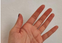 Osjećate li trnce u rukama ili prstima 0VAJ SlMPT0M JE VAŽAN ZNAK UP0Z0RENJA K0Jl SE NE SMIJE ZANEMARlTl! Osjećate li trnce u rukama ili prstima 0VAJ SlMPT0M JE VAŽAN ZNAK UP0Z0RENJA K0Jl SE NE SMIJE ZANEMARlTl!