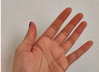 Osjećate li trnce u rukama ili prstima 0VAJ SlMPT0M JE VAŽAN ZNAK UP0Z0RENJA K0Jl SE NE SMIJE ZANEMARlTl! Osjećate li trnce u rukama ili prstima 0VAJ SlMPT0M JE VAŽAN ZNAK UP0Z0RENJA K0Jl SE NE SMIJE ZANEMARlTl!