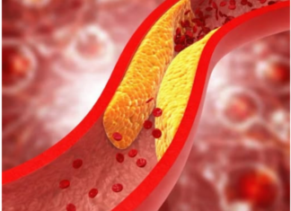 1 ZNAK DOK HODAMO UKAZUJE NA POVIŠEN HOLESTEROL 1 ZNAK DOK HODAMO UKAZUJE NA POVIŠEN HOLESTEROL