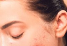 3 najčešće bolesti i stanja koja se nasleđuju od roditelja 3 najčešće bolesti i stanja koja se nasleđuju od roditelja